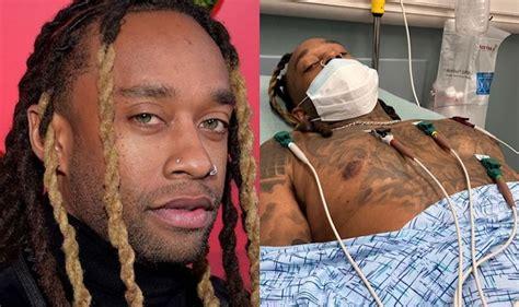 Ty Dolla $ign is out of hospital, after revealing that he suffered a skating accident