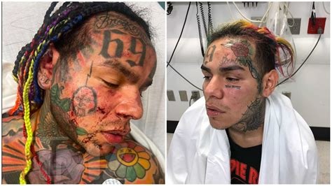 6ix9ine Rushed To The Hospital After Being Brutally Attacked At LA Fitness